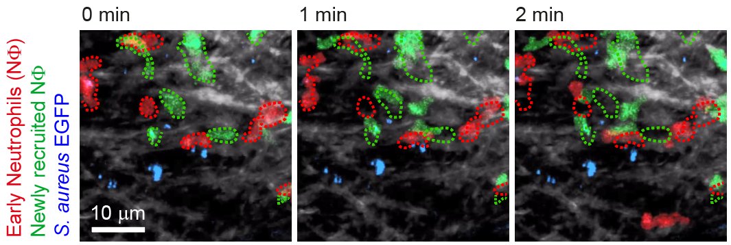 Abbildung Thema Myeloide