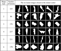 CSVD Biomarker characterisation