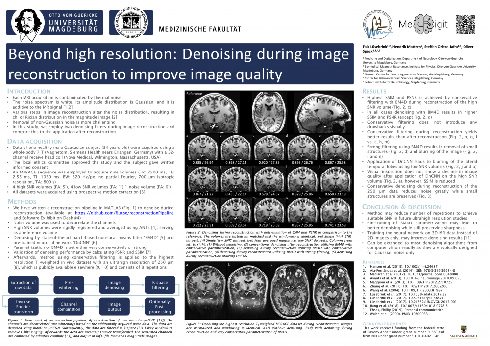 Poster ESMRMB 2019-Beyond_high_resolution_denoising-FL