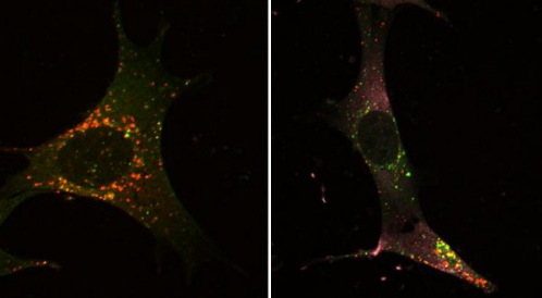 Mit dem Mikroskop zoomen Forscher in Zellen hinein: Läuft die Autophagie ungestört ab, beobachten sie Verdauungsbläschen, in Rot dargestellt, in denen Material abgebaut wird (links). Ist der letzte Schritt blockiert, sammeln sich Autophagosomen an, in Grün dargestellt (rechts). Die dunkle Kreisfläche in der Mitte ist der Zellkern.