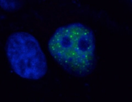 Verkehrspolizisten im Immunsystem